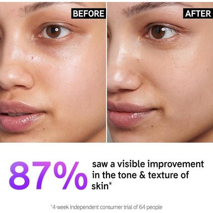 The INKEY List 15% Vitamin C and EGF Serum Intensively Brightens All Skin Types 30ml - Maison des fragrances